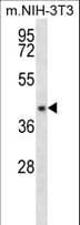 Polyclonal Rabbit anti-Human NUDT9 Antibody (aa318-346, IHC, WB)