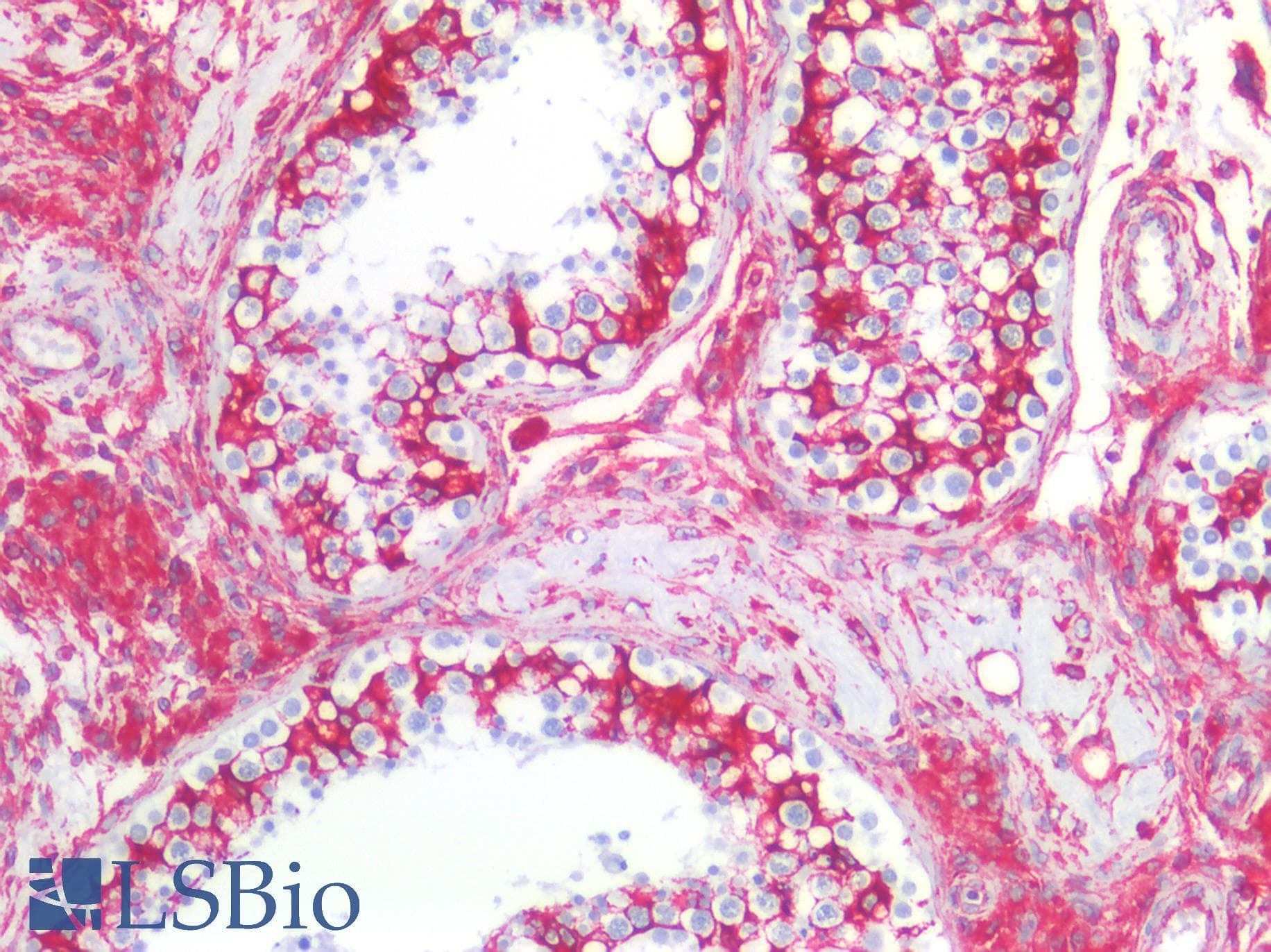 PathPlus™ Vimentin Antibody