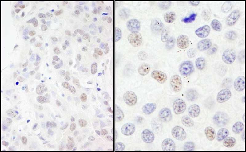 IHC-plus™ Polyclonal Rabbit anti-Human NBN / Nibrin Antibody (aa425-475, IHC, WB)