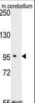 SEMA6A / Semaphorin 6A Antibody (aa998-1028)