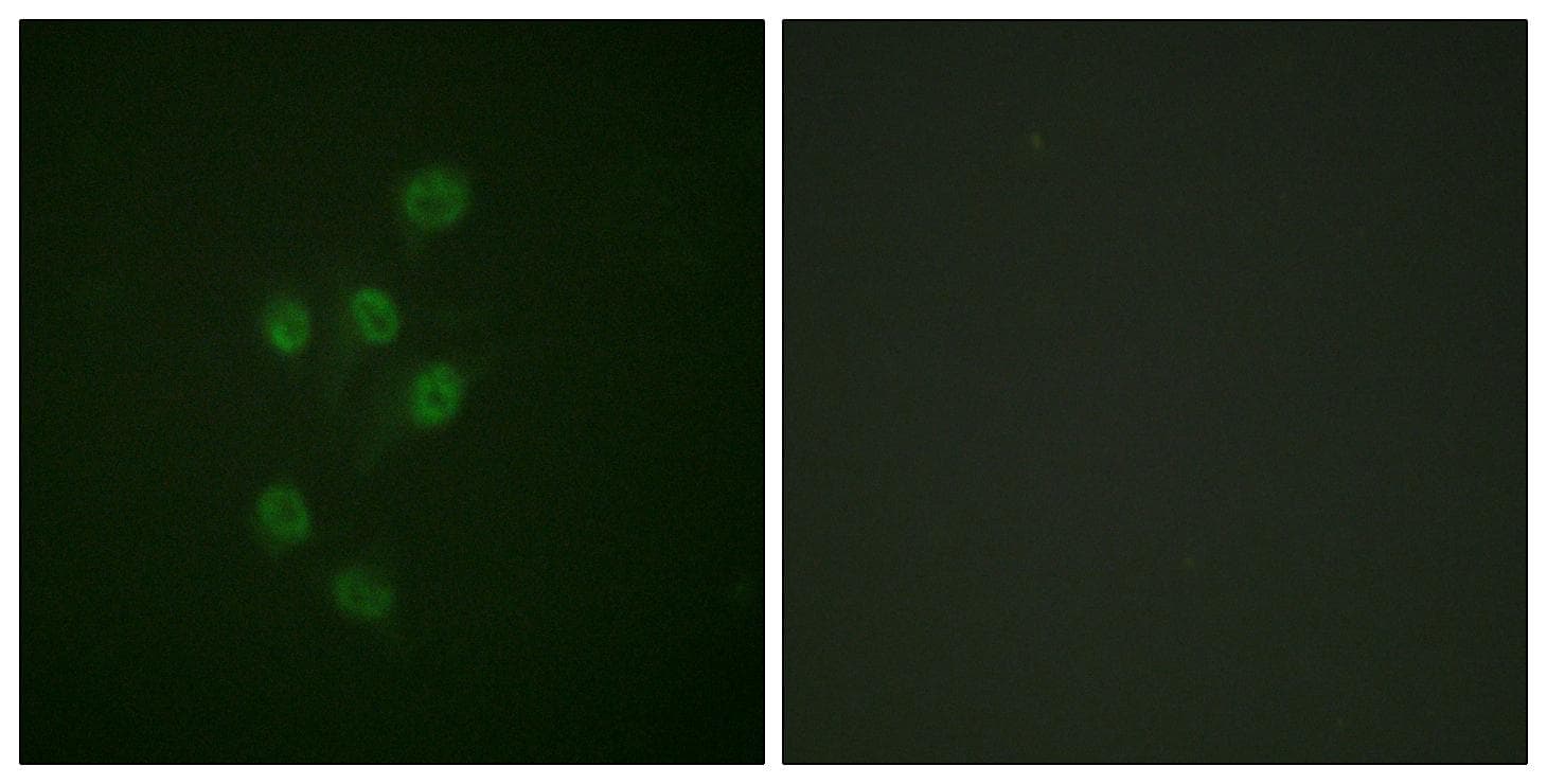 Polyclonal Rabbit anti-Human HDAC3 Antibody (phospho-Ser424, IHC, IF, WB)