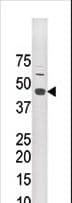 STRADA / LYK5 Antibody (aa12-41)