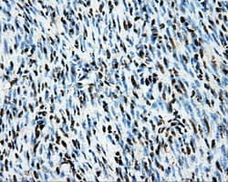 LOX / Lysyl Oxidase Antibody (clone OTI9G6)