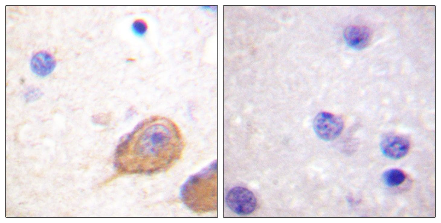 NOS1 / nNOS Antibody (phospho-Ser852)