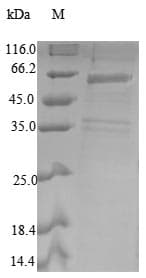 Human COPS2 / TRIP15 / ALIEN Protein (Recombinant 6His-SUMO, N-terminus)