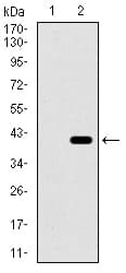 ITGA2B / CD41 Antibody (aa45-149, clone 2E10C9)