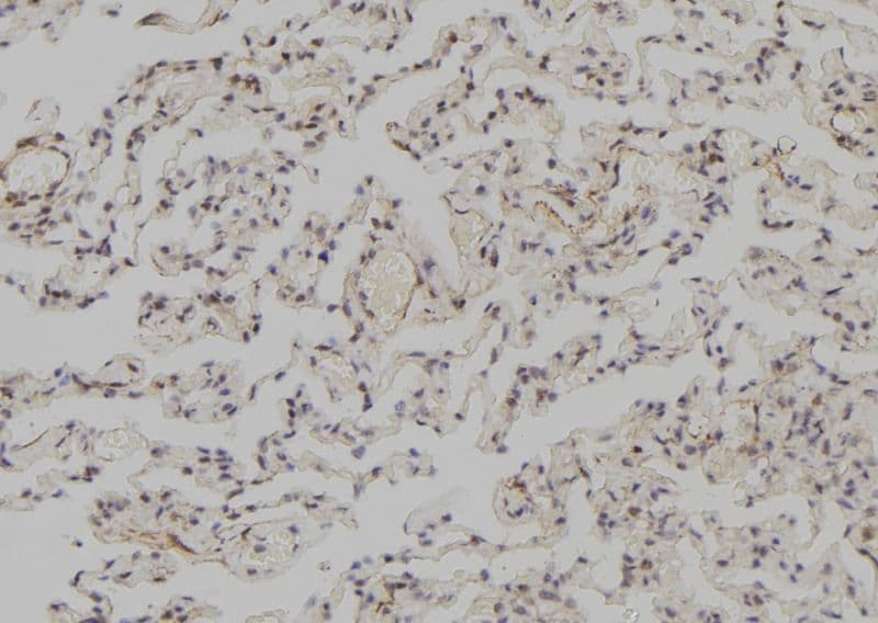 Polyclonal Rabbit anti-Human SNAPC3 Antibody (IHC, WB)