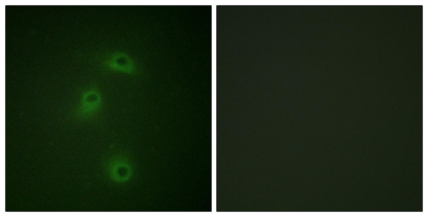 DAPK2 / DAP Kinase 2 Antibody (phospho-Ser318)