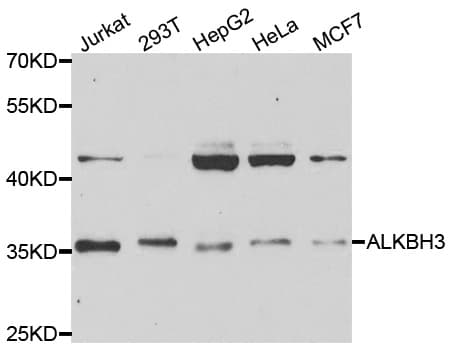 PCA1 / ALKBH3 Antibody