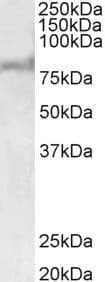 ABCD2 / ALDR Antibody (aa460-473)