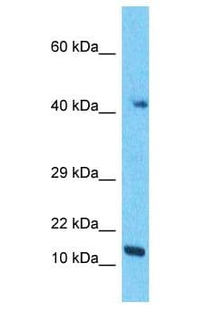 Polyclonal Rabbit anti-Human RMND5B Antibody (aa10-59, WB)