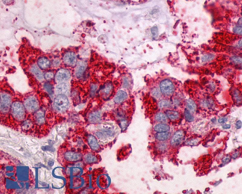 PathPlus™ Polyclonal Rabbit anti-Human NTSR1 / NTR Antibody (N-Terminus, IHC)