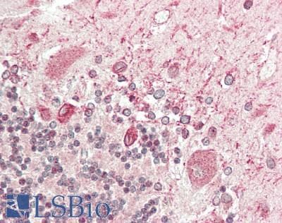 IHC-plus™ PSAP / Prosaposin Antibody (aa291-340)
