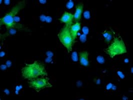 PTPN7 / HEPTP Antibody (clone OTI3B10)