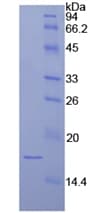 Human LAMA1 / Laminin Alpha 1 Protein (Recombinant His)