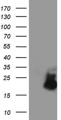 AVPI1 Antibody (clone OTI1G1)