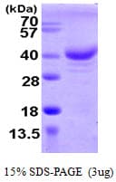 Human ZCCHC17 / PNO40 / PS1D Protein (Recombinant His)