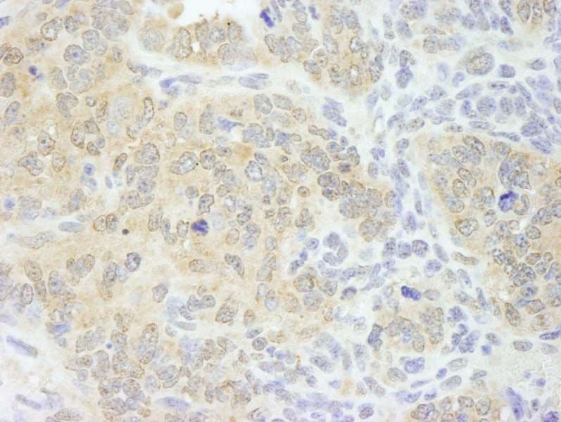 EIF4G1 / EIF4G Antibody (aa525-575)