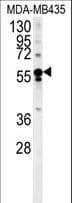 ARHGEF3 / XPLN Antibody (aa211-240)
