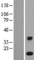 PLA2G1B Protein (Over-Expression Lysate Myc-DDK (Flag))