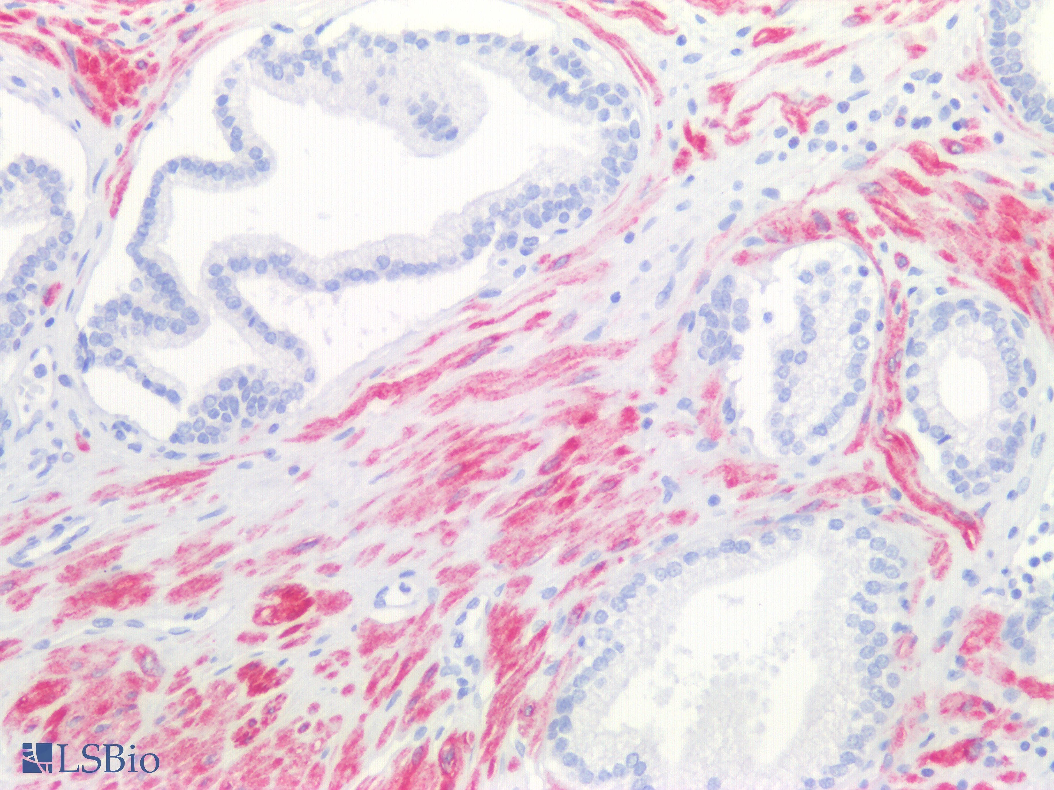 PathPlus™ CNN1 / Calponin Antibody (Internal)