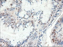 PTCH1 / Patched 1 Antibody (clone OTI5C7)
