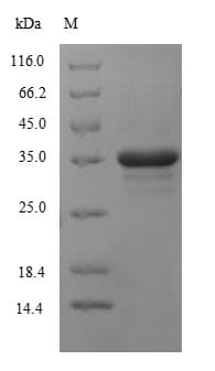 Human CYBB / NOX2 / gp91phox Protein (Recombinant 6His-SUMO, N-terminus)