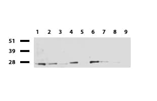 C14orf166 Antibody (clone UMAB182)