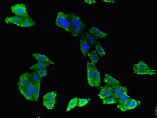 Polyclonal Rabbit anti-Human ABCB9 Antibody (IF, WB)