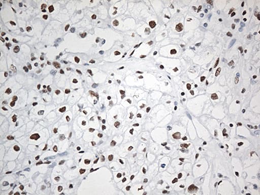 EWSR1 / EWS Antibody (aa256-447, clone OTI3F6, Carrier-free)