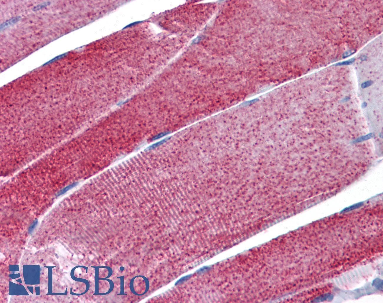 IHC-plus™ Monoclonal Mouse anti-Human IDH2 Antibody (clone 5F11, IHC, WB)