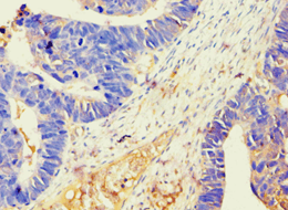 BAG2 Antibody (aa1-211)