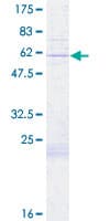 Human COX11 Protein (Recombinant GST)