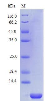 Human CXCL6 Protein (Recombinant)