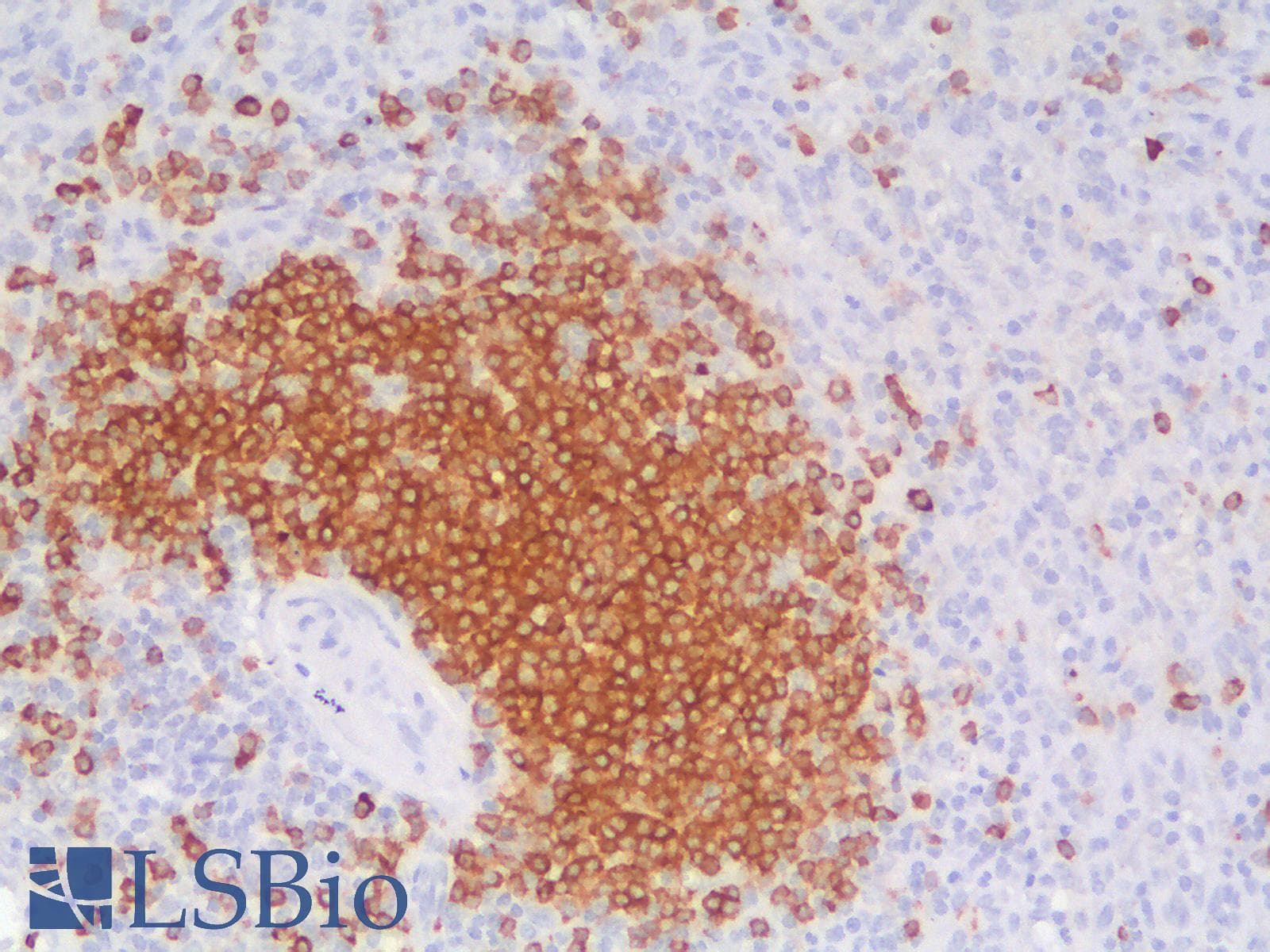 PathPlus™ CD79A / CD79 Alpha Antibody (aa202-216, clone IGA/1688R)