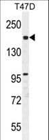 Polyclonal Rabbit anti-Human FHAD1 Antibody (aa1145-1173, IHC, WB)