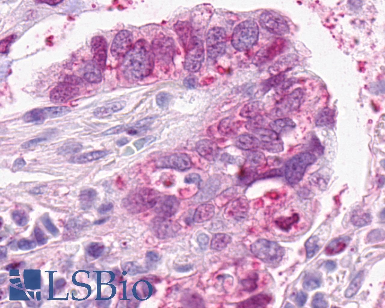 IHC-plus™ SSTR4 Antibody (N-Terminus)