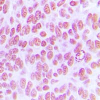 JUN / c-Jun Antibody (phospho-Tyr170)