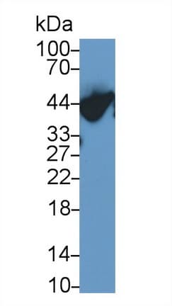 ORM1 / Orosomucoid Antibody (aa19-201)