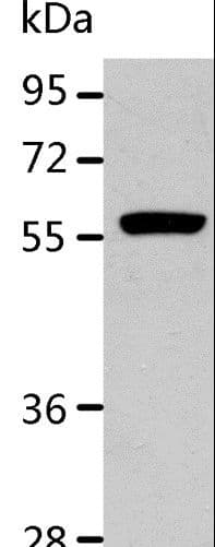 RALDH2 / ALDH1A2 Antibody
