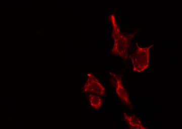 SARA2 / SAR1B Antibody