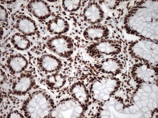 TRIM28 / KAP1 Antibody (clone OTI2H10, Carrier-free)