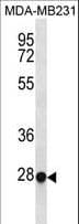 TFEC Antibody (aa179-205)