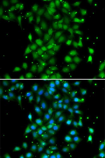 UBE2Z / USE1 Antibody