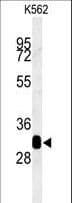 Polyclonal Rabbit anti-Human RDH16 Antibody (aa3-31, IHC, WB)