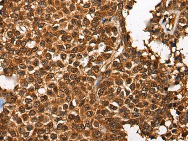 CDKL4 Antibody