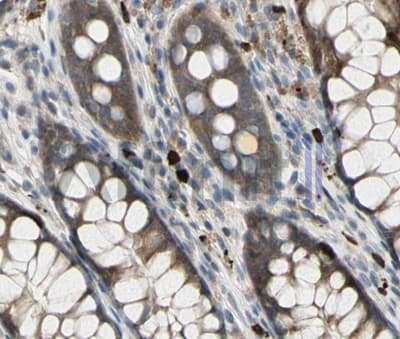 GJB1 / CX32 / Connexin 32 Antibody