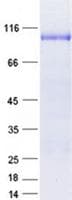 Human GLIS1 Protein (Recombinant GST, N-terminus + His, C-terminus)