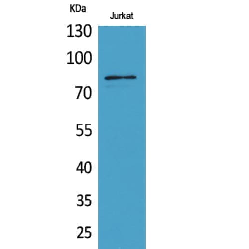 PREP / Prolyl Endopeptidase Antibody (10-90 aa, N-terminal)