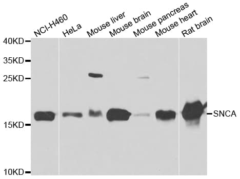 Polyclonal Rabbit anti-Human SNCA / Alpha-Synuclein Antibody (IHC, IF, WB)